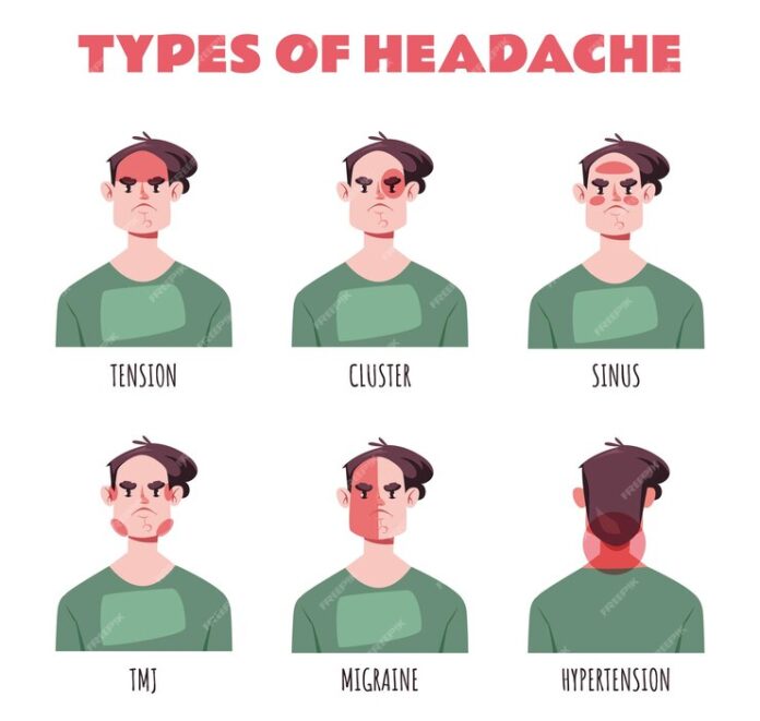 https://entrepreneurways.com/different-types-of-headaches/